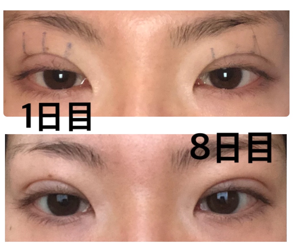 f:id:Ri9Gr:20220115110326j:image