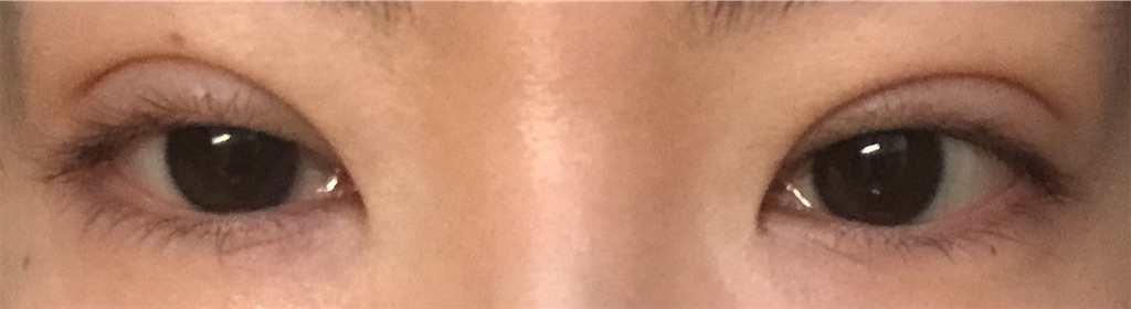 f:id:Ri9Gr:20220121220022j:image f:id:Ri9Gr:20220121220022j:image