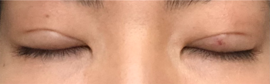 f:id:Ri9Gr:20220122102146j:image f:id:Ri9Gr:20220122102146j:image