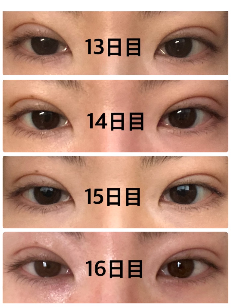 f:id:Ri9Gr:20220123095611j:image f:id:Ri9Gr:20220123095611j:image