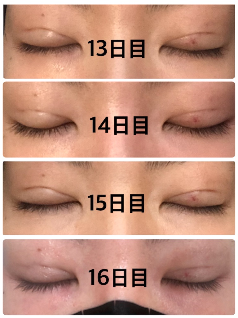 f:id:Ri9Gr:20220123095635j:image f:id:Ri9Gr:20220123095635j:image