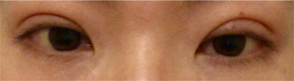 f:id:Ri9Gr:20220123100156j:image f:id:Ri9Gr:20220123100156j:image