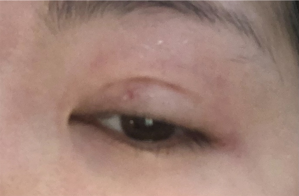 f:id:Ri9Gr:20220123100408j:image f:id:Ri9Gr:20220123100408j:image