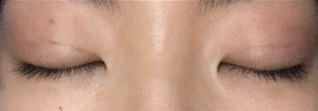 f:id:Ri9Gr:20220126144637j:image