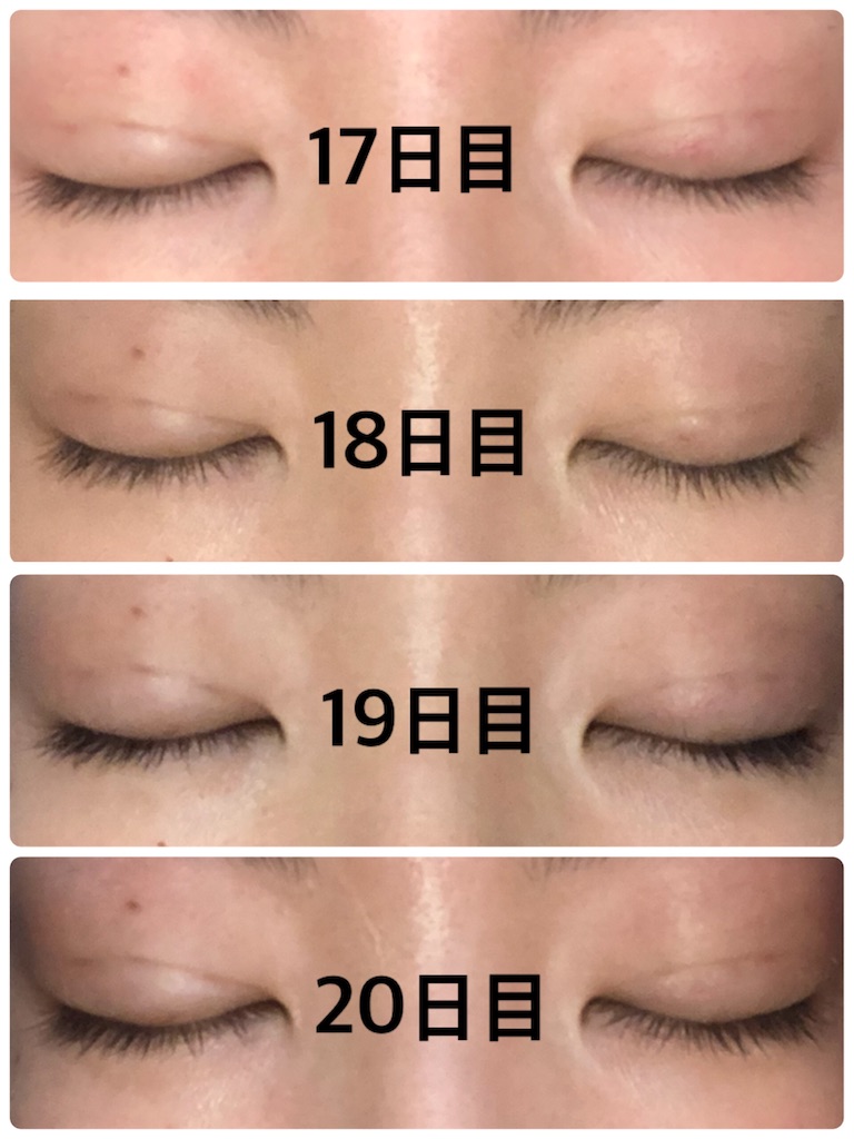 f:id:Ri9Gr:20220127204637j:image