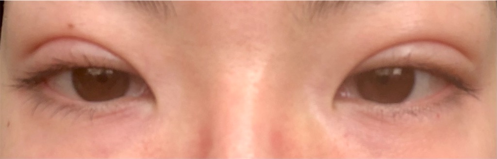 f:id:Ri9Gr:20220208225818j:image