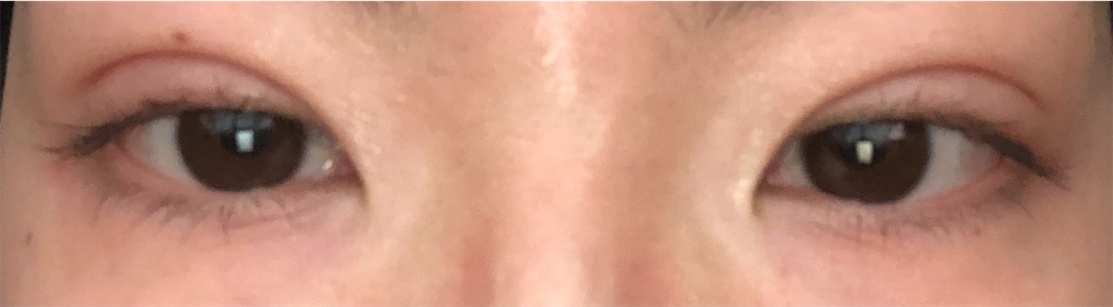 f:id:Ri9Gr:20220208225838j:image