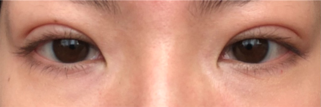 f:id:Ri9Gr:20220208225854j:image