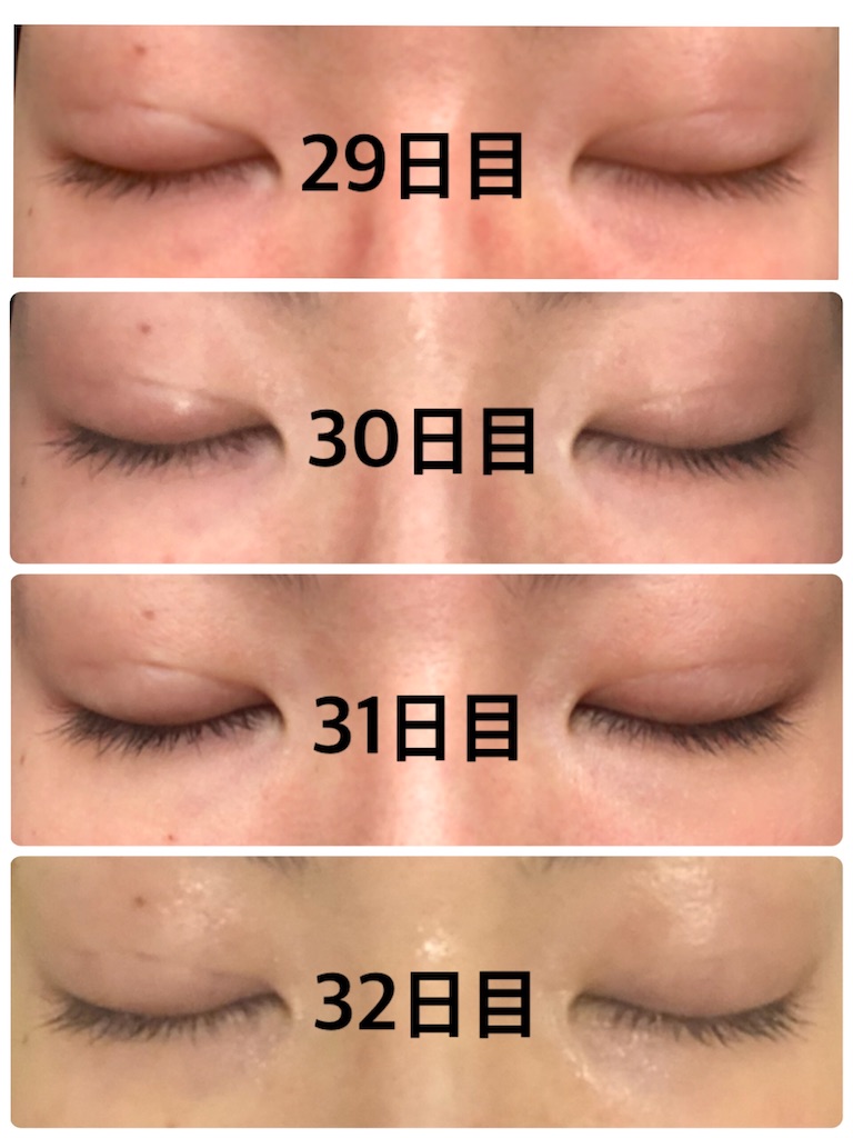 f:id:Ri9Gr:20220208232824j:image