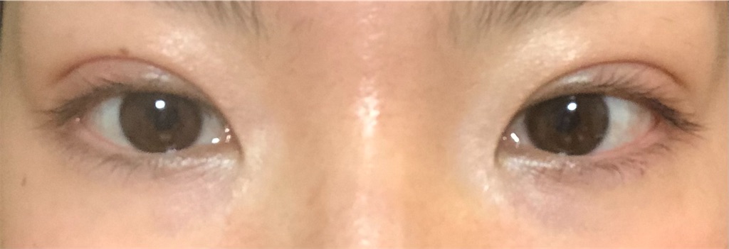 f:id:Ri9Gr:20220305221633j:image