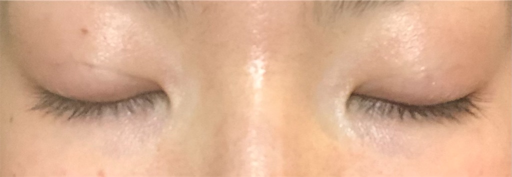 f:id:Ri9Gr:20220305221636j:image