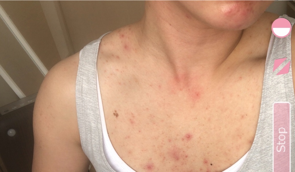 f:id:Ri9Gr:20220604214745j:image f:id:Ri9Gr:20220604214745j:image