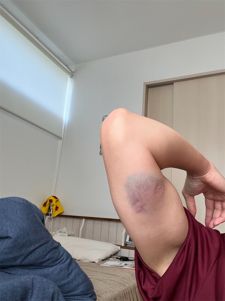 f:id:Ri9Gr:20221127205857j:image