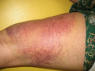 f:id:RlE:20160804185601j:plain