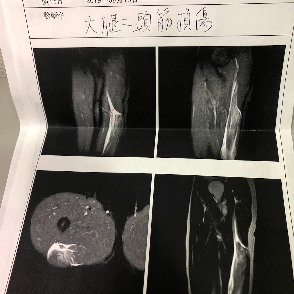 f:id:Rman-climbing:20190928172637j:image
