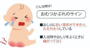 f:id:RyoEnko:20211020155029p:plain