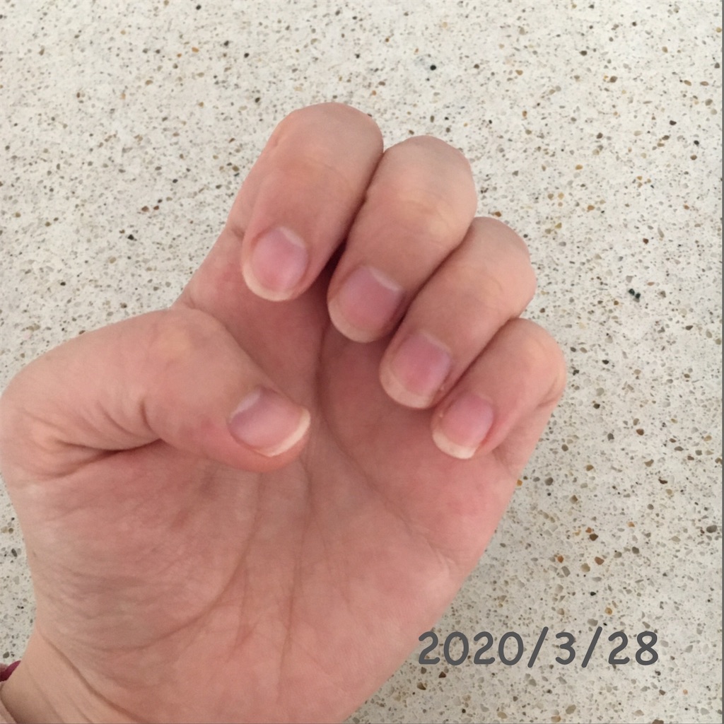 ダウンロード済み 親指 爪 横長 ネイル画像だけ ダウンロード済み 親指 爪 横長 ネイル画像だけ