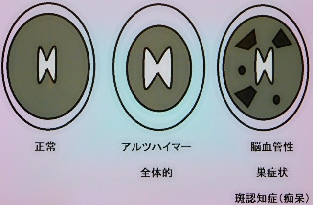 f:id:SAKI001:20180118191322j:image f:id:SAKI001:20180118191322j:image