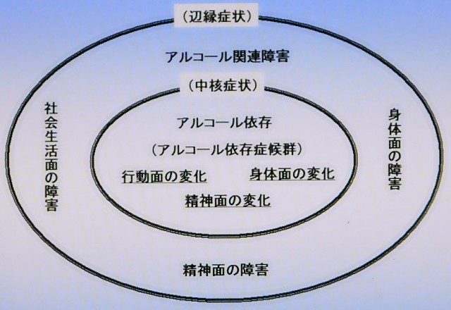 精神医学シリーズ 4 アルコール症 - saki001のブログ