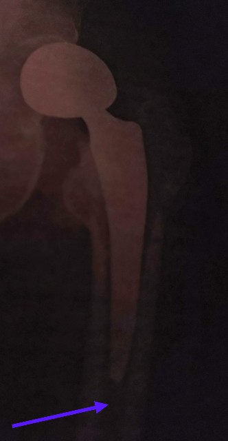 f:id:SAKI001:20250427162247j:image