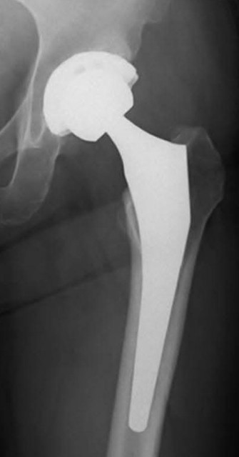 f:id:SAKI001:20250726115122j:image