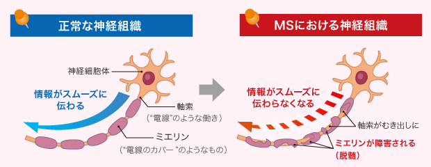 f:id:SIRISIRI:20160926095334g:plain