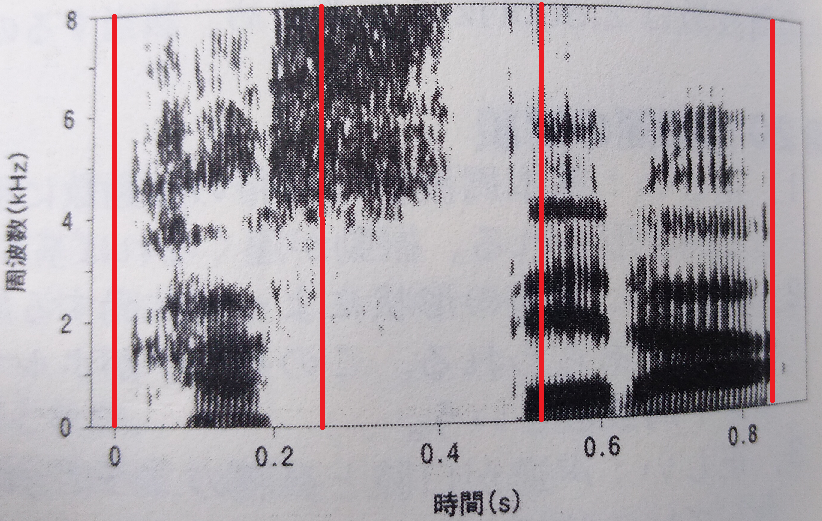 言語聴覚士 国家試験合格への道 サウンドスペクトログラム①