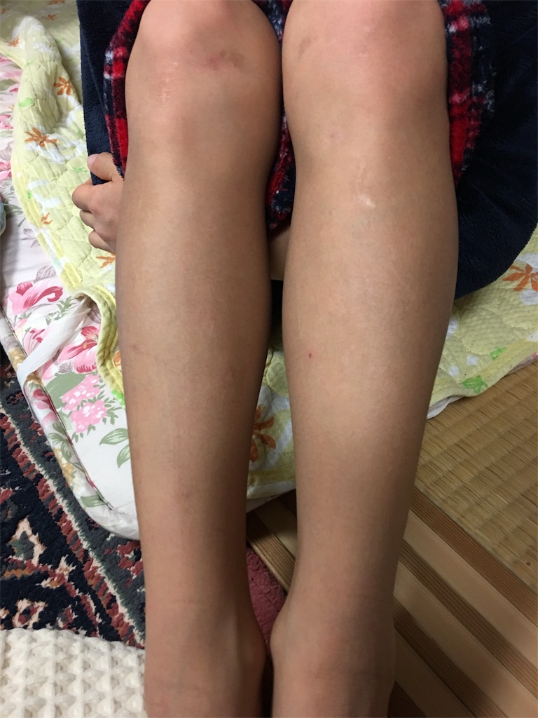 f:id:SYUREI:20190108143937j:image