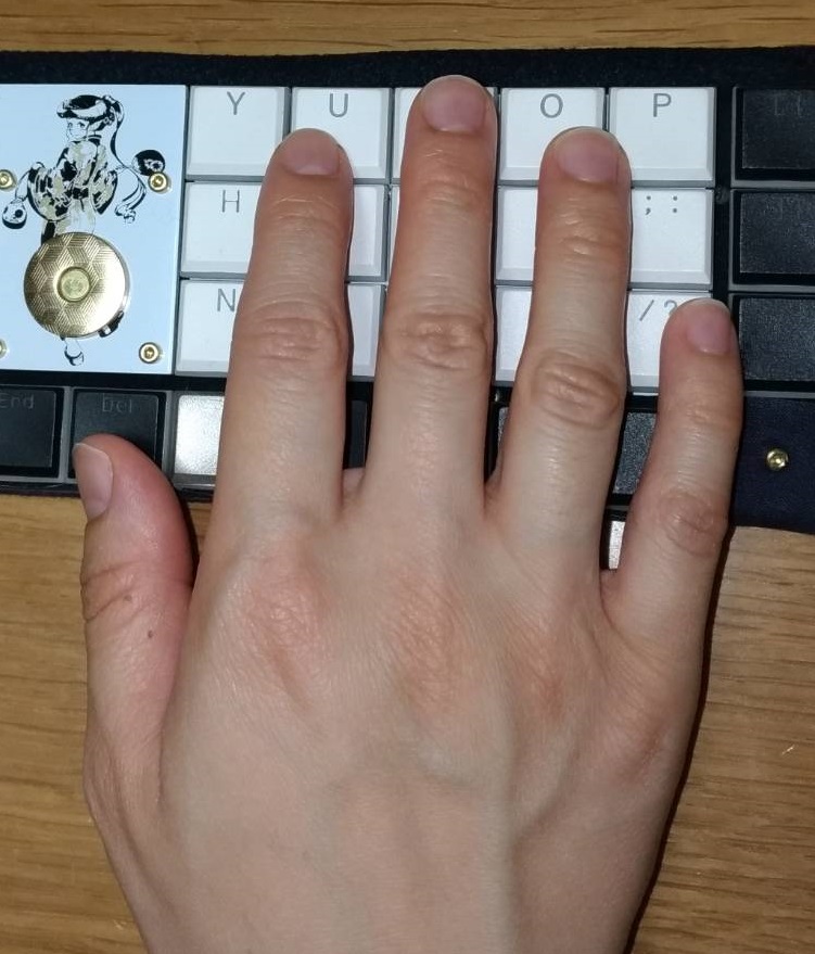 f:id:Salicylic_acid3:20190608000506j:plain f:id:Salicylic_acid3:20190608000506j:plain