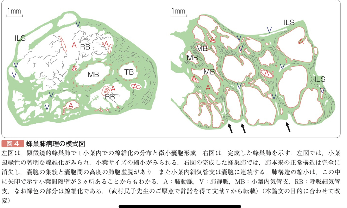 【裁断済み】非腫瘍性疾患病理アトラス 消化管 51i2DVMAWxL.jpg