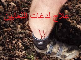 f:id:ShaimaHussein:20170621092310j:plain