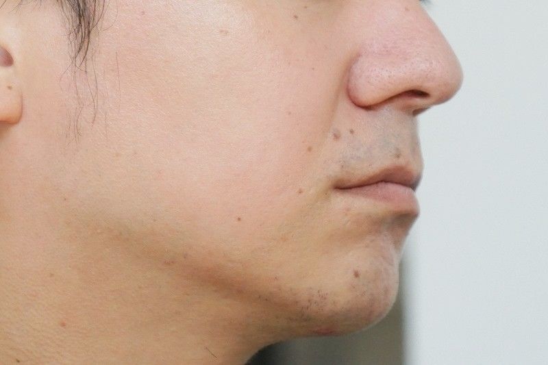 f:id:Sig-Maru:20210823171742j:plain