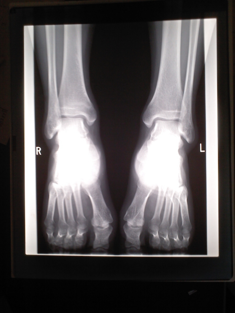 f:id:Sphingoid:20170520125735j:plain