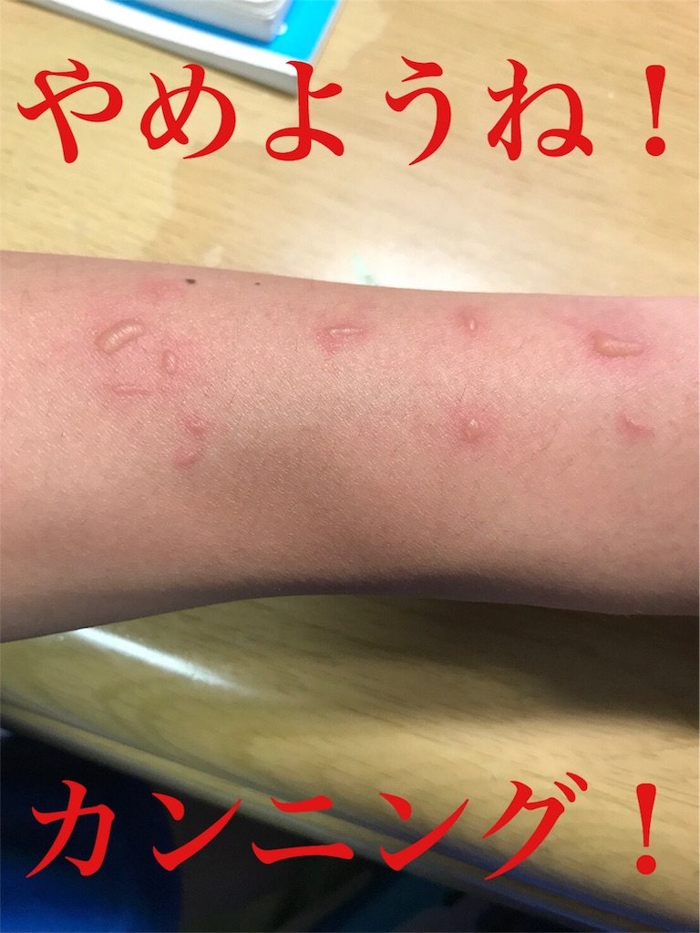 f:id:Suke873:20180120101643j:image f:id:Suke873:20180120101643j:image