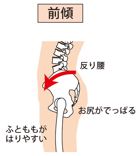 反り腰になってませんか 骨盤の前傾は内臓機能低下の原因にも からだ活き活き You Are What You Eat