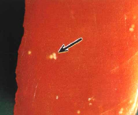 バチマグロの筋肉に寄生している粘液胞子虫のシスト画像（東京都保健医療局）
