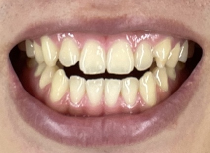 f:id:Takashix0328:20211030170046j:plain