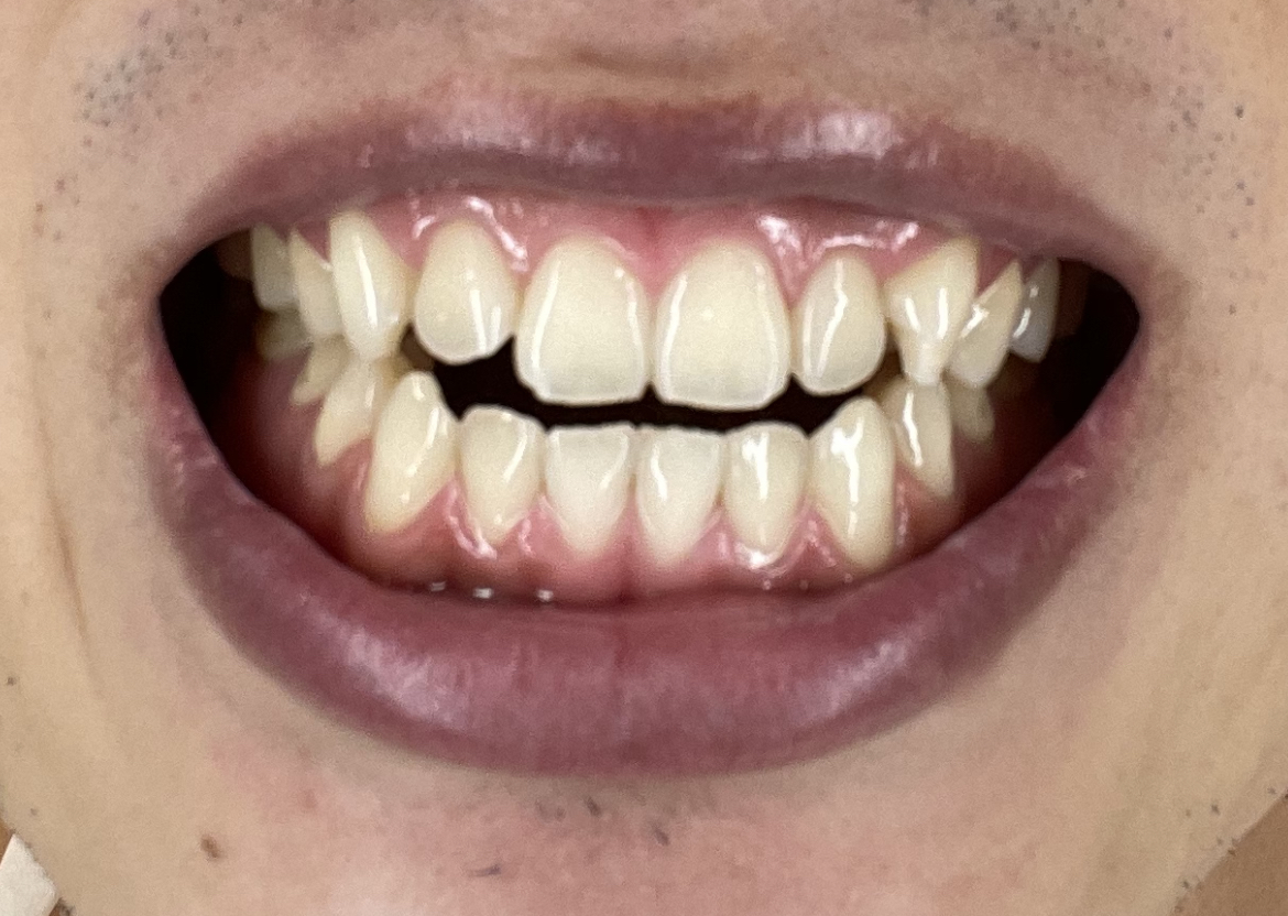 f:id:Takashix0328:20211030170825j:plain