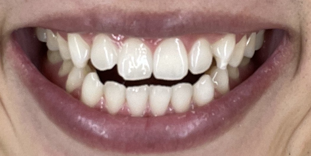 f:id:Takashix0328:20211030171813j:plain