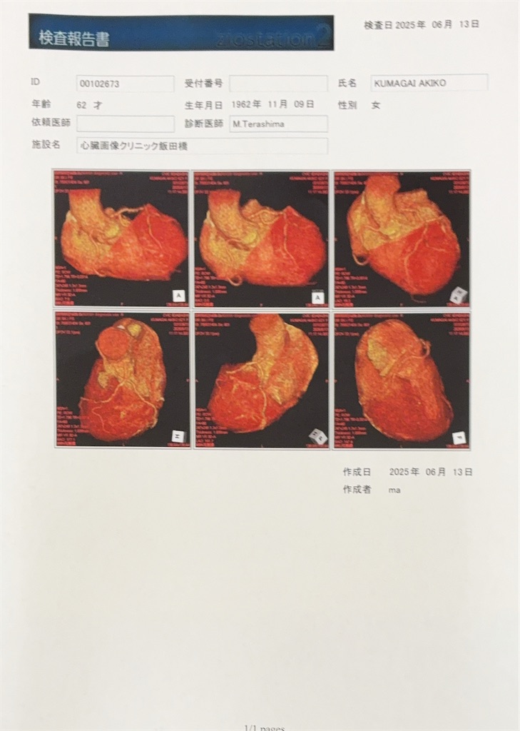 f:id:TokuheiKumagai:20250624150234j:image