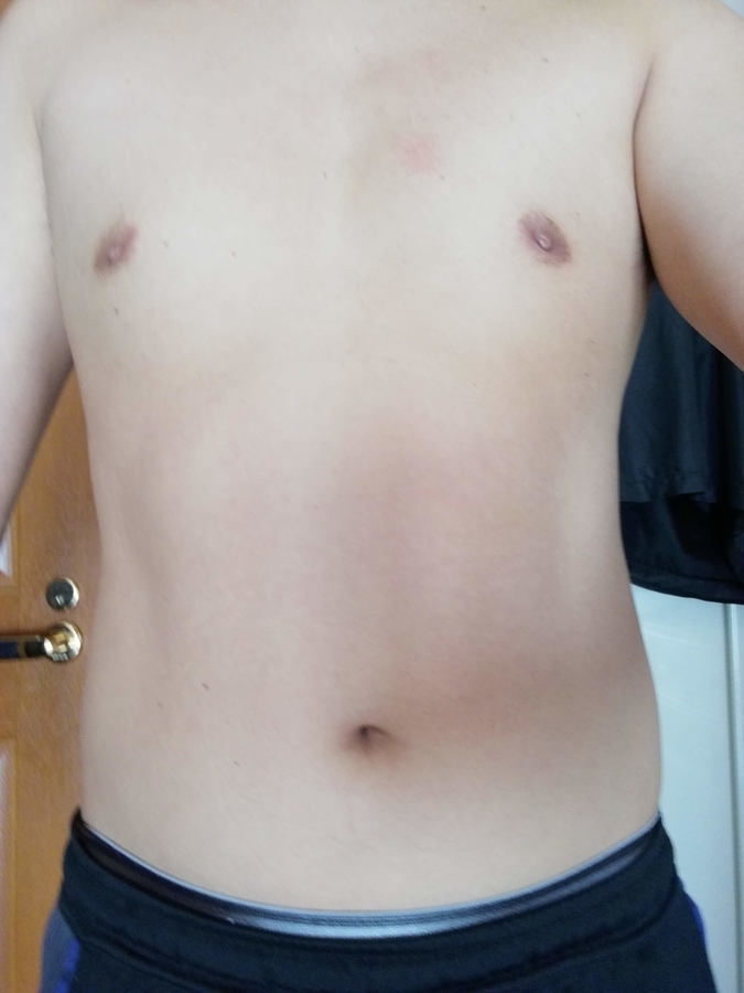 f:id:Tristan0:20190616084440j:plain f:id:Tristan0:20190616084440j:plain