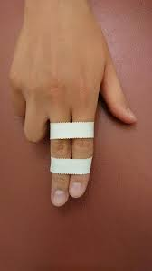 パキるとどうなる ー原因と対処方法ー 鬼軍ちゃんボルダリング パキるとどうなる ー原因と対処方法ー 鬼軍ちゃんボルダリング