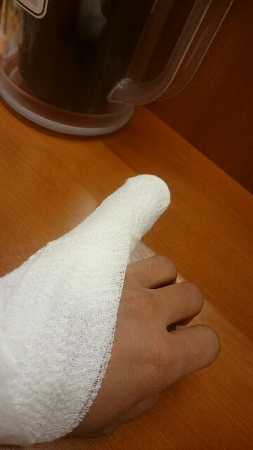 骨折したんです 原因 Weekendriderによるmoto B Log