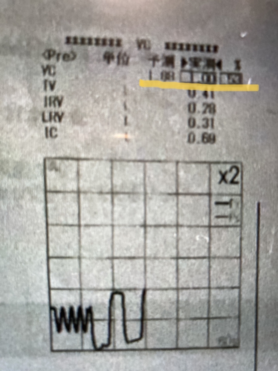f:id:YAMAGA:20220116074123j:plain