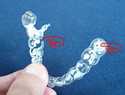 前回壊れたマウスピース