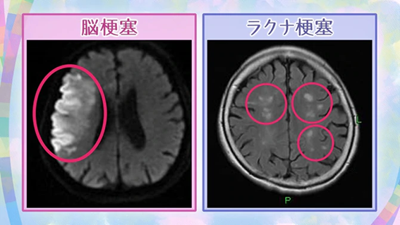 f:id:abt875c:20200802102217p:plain f:id:abt875c:20200802102217p:plain