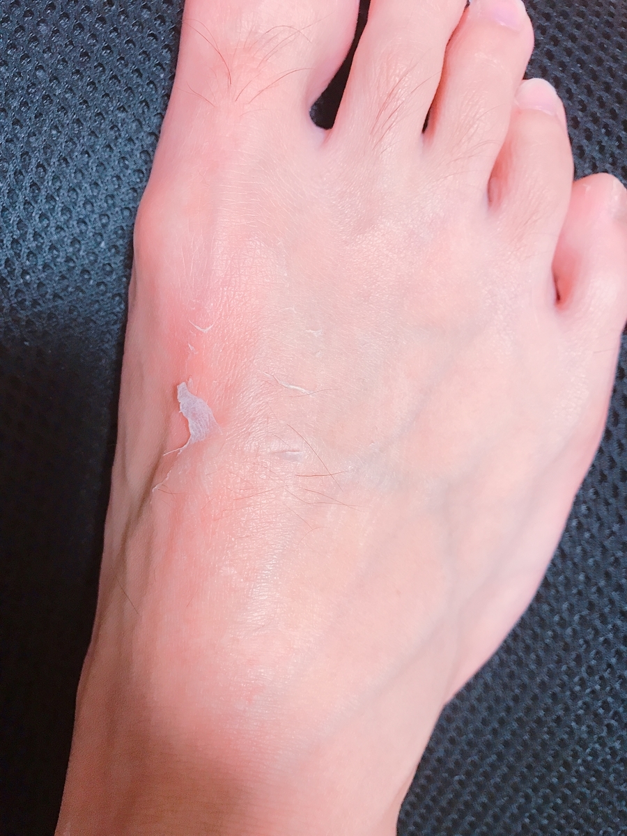 f:id:achipion:20190613231432j:plain f:id:achipion:20190613231432j:plain