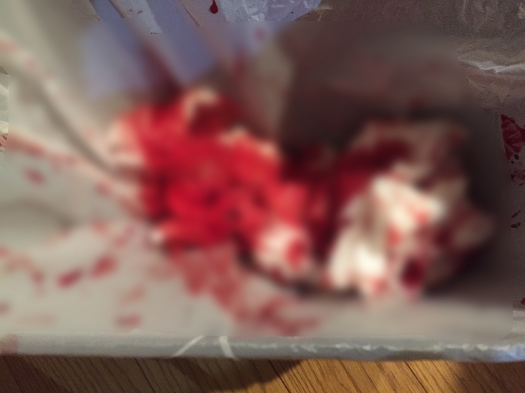 f:id:acsekitori:20180306154911j:plain