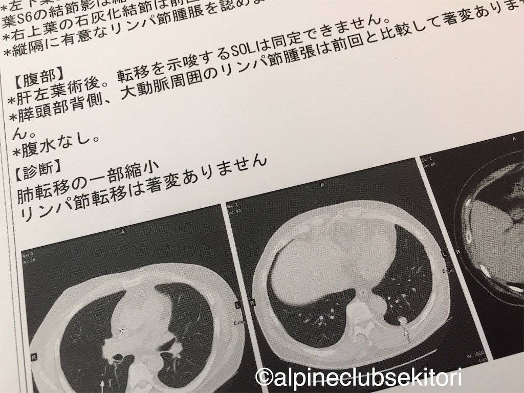 f:id:acsekitori:20180828161300j:image