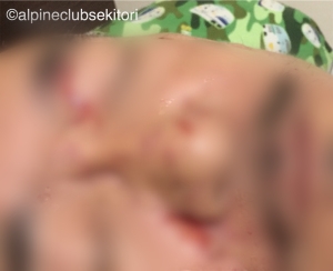 f:id:acsekitori:20180828163544j:plain